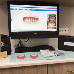 MGM Dental - Invisalign case.