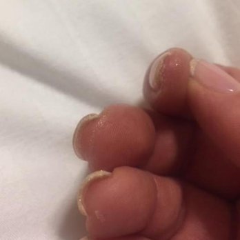 Edinburgh Beauty Quarter - Left the salon with blotches of white from the French manicure all over my skin as well as the gold top coat. They refused to fix.  Yikes! - Beauty & Spas Near Me - Edinburgh, EDH