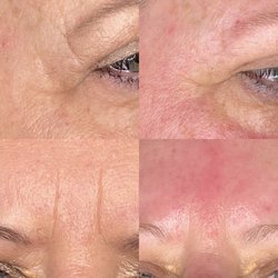 Sculpting Beauty by Pam - Skin Tightening