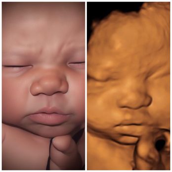 Sneak A Baby Peek - Ultrasound Imaging Centers Near Me - Laughlin, Nevada Sneak A Baby Peek - Ultrasound Imaging Centers Near Me - Laughlin, Nevada