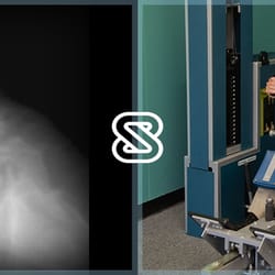 SpineZone Physical Therapy - Rancho Bernardo - The SpineZone Program isolates, strengthens and stabilizes the vertebrae and can reduce the impact of a Spondylolisthesis