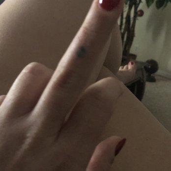 Renewal Laser Tattoo Removal - before - Tattoo Removal Near Me - Lake Worth, Florida