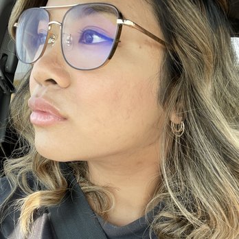 Gravitas Medspa - Day 2 after my 1st skin veneer, stem cell and magic foundation - Permanent Makeup Near Me - Beverly Hills, California