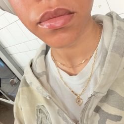 UPKEEP - Lips after