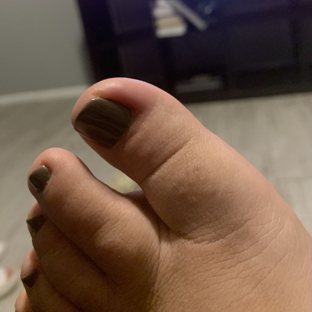 Pedicure gone wrong my toes hurt