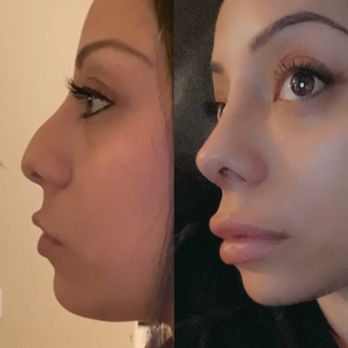 Dr. Herrera Rivera Mariano - 3 weeks. More and more in love with it as the days pass! - Ear Nose & Throat Near Me - Tijuana, BCN Dr. Herrera Rivera Mariano - 3 weeks. More and more in love with it as the days pass! - Ear Nose & Throat Near Me - Tijuana, BCN