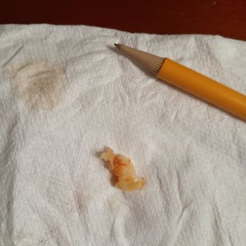 Mandarin Kitchen - THIS tiny thing beside the pencil is the shrimp! - Cantonese Near Me - Des Moines, Washington