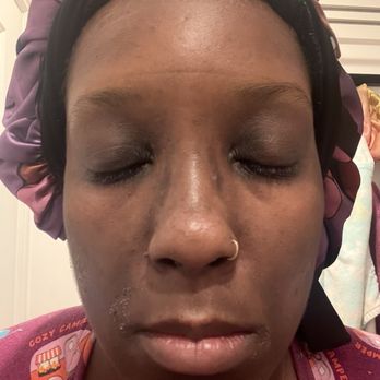 Derm by Erica - Skin Care Near Me - Culver City, California