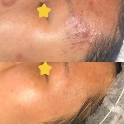 Amazing Skin