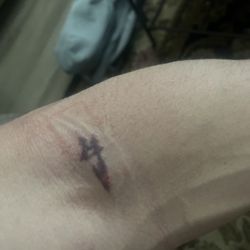 Missed IV