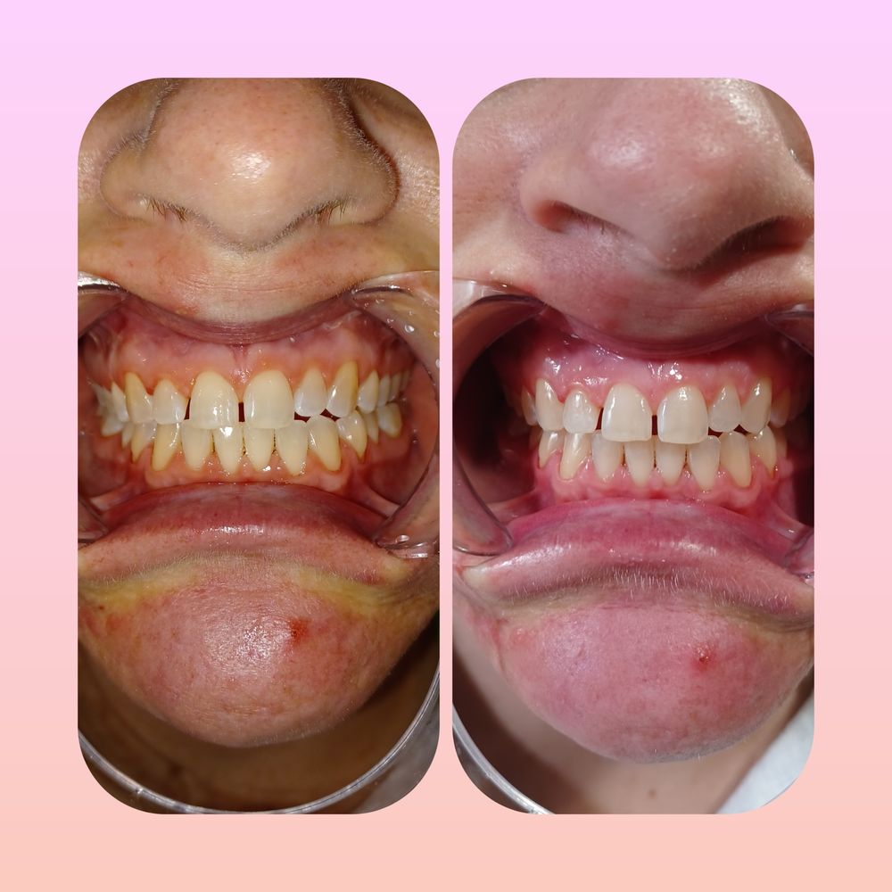 Hydrofacials By Michelle Logo