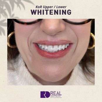 Real Dentistry - Whitening - Cosmetic Dentists Near Me - Fullerton, California Real Dentistry - Whitening - Cosmetic Dentists Near Me - Fullerton, California