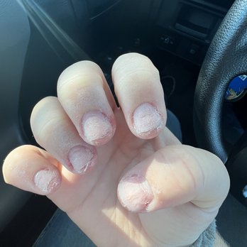 Professio Nails - Destroyed nails - Nail Salons Near Me - Ventura, California Professio Nails - Destroyed nails - Nail Salons Near Me - Ventura, California