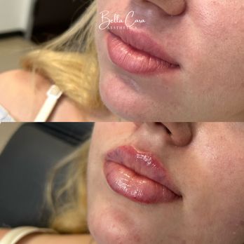 Bella Cara Aesthetics - Medical Spas Near Me - Newport Beach, California Bella Cara Aesthetics - Medical Spas Near Me - Newport Beach, California
