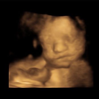 Advanced Ultrasound Services - Diagnostic Imaging Near Me - Tampa, Florida Advanced Ultrasound Services - Diagnostic Imaging Near Me - Tampa, Florida