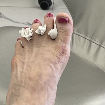Tru Nail Spa - This foot got smeared onto my new Birkenstock by the girl. - Nail Salons Near Me - Los Alamitos, California Tru Nail Spa - This foot got smeared onto my new Birkenstock by the girl. - Nail Salons Near Me - Los Alamitos, California