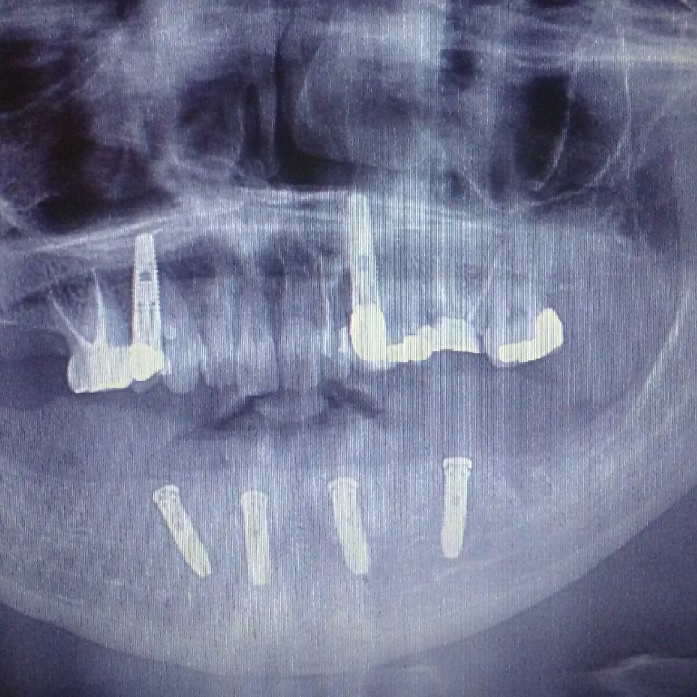 Gregory W Jackson, DDS - Final solution - Orthodontists Near Me - Chicago, Illinois Gregory W Jackson, DDS - Final solution - Orthodontists Near Me - Chicago, Illinois
