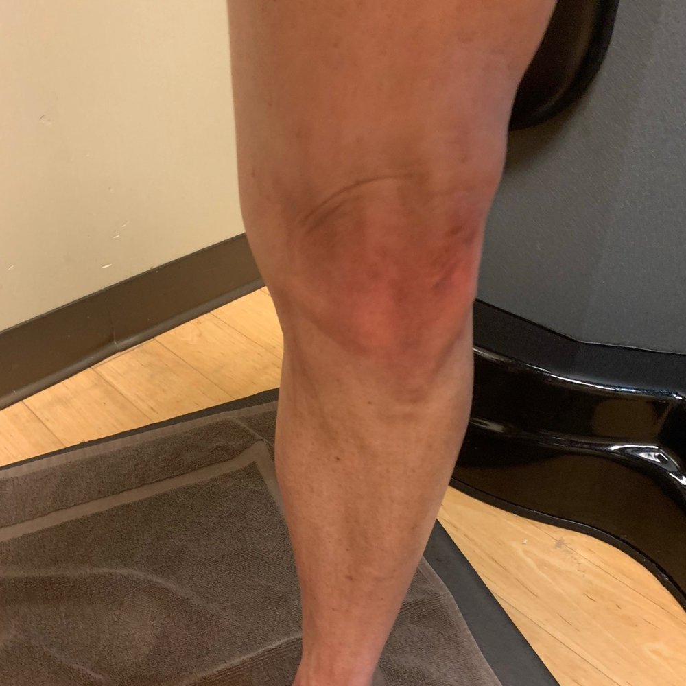 Palm Beach Tan - After scrubbing my leg - Skin Care Near Me - Rowlett, Texas