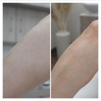 Dovian Haus - Leg Waxing - Waxing Near Me - Irvine, California Dovian Haus - Leg Waxing - Waxing Near Me - Irvine, California