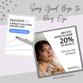 Le Eye Spa - Optilight IPL featured treatment at Le Eye Spa. Targeting dry eye disease and improving eyelid aesthetics. Tighten|Brighten|Rejuvenate - Optometrists Near Me - Las Vegas, Nevada Le Eye Spa - Optilight IPL featured treatment at Le Eye Spa. Targeting dry eye disease and improving eyelid aesthetics. Tighten|Brighten|Rejuvenate - Optometrists Near Me - Las Vegas, Nevada