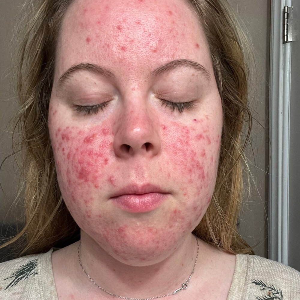 Aesthetic Glo - After my first treatment - Eyelash Service Near Me - Granada Hills, California Aesthetic Glo - After my first treatment - Eyelash Service Near Me - Granada Hills, California