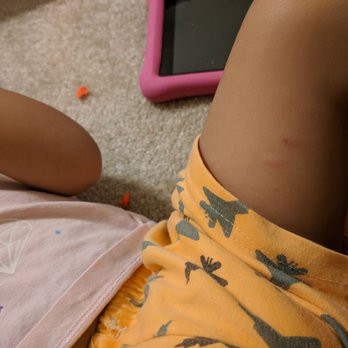 Yarrow Bay KinderCare - Hurt my daughter on day 1 of daycare. - Child Care & Day Care Near Me - Bellevue, Washington