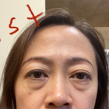 M Beauty Day Spa - First session Eyebag treatment - Massage Near Me - Westfield, New Jersey M Beauty Day Spa - First session Eyebag treatment - Massage Near Me - Westfield, New Jersey
