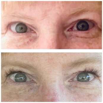 Amazing Lash Studio - Before and after - Eyelash Service Near Me - Burke, Virginia