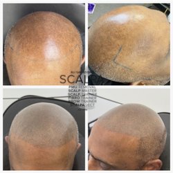 Scalp Aesthetics Dearborn
