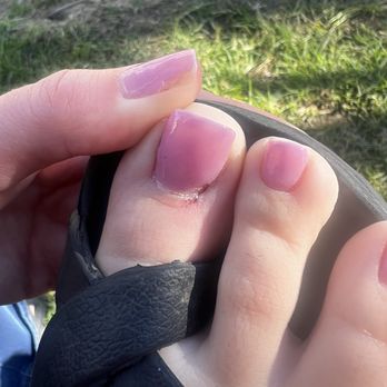 Chloe Nail Spa - Nipped cuticle and missing polish at base - Nail Salons Near Me - Sherman Oaks, California Chloe Nail Spa - Nipped cuticle and missing polish at base - Nail Salons Near Me - Sherman Oaks, California