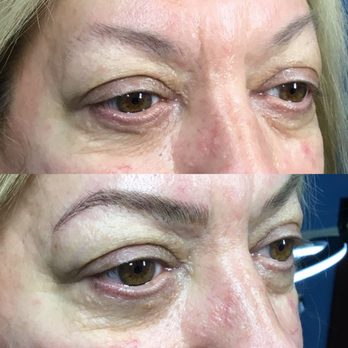 Kefi Aesthetics - Microblading - Waxing Near Me - Avon, Connecticut Kefi Aesthetics - Microblading - Waxing Near Me - Avon, Connecticut