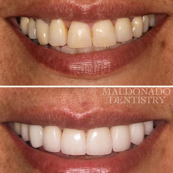 Maldonado Dentistry - General Dentistry Near Me - Treasure Island, Florida Maldonado Dentistry - General Dentistry Near Me - Treasure Island, Florida