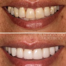 Maldonado Dentistry