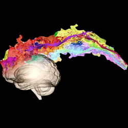 Kim The Brain Healer - The Neurodivergent. I do things a bit differently. Unconventional Healing