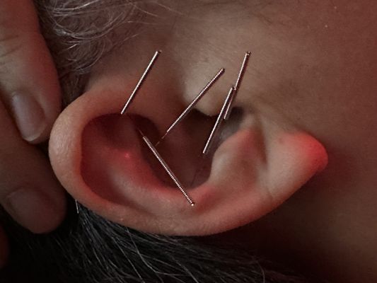 Thành Nguyễn Li & Nguyen Dental Corp, 2707 E Valley Blvd, Ste 301, West Covina