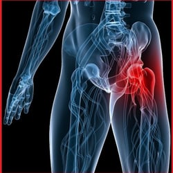 Relief Acupuncture Pennington Hopewell - We treat hip pain.