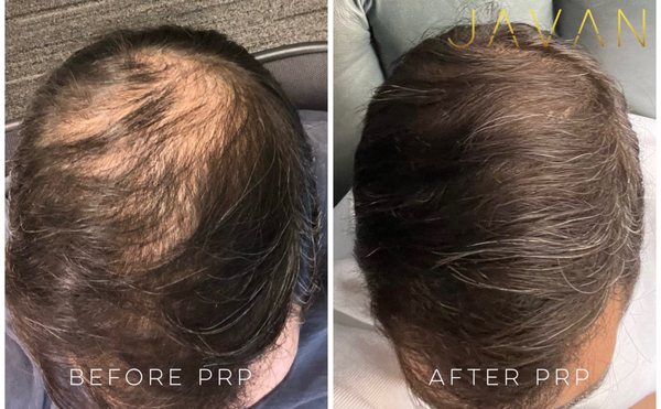 Javan Wellness by null