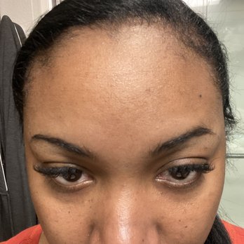 Lily Aesthetics & Wellness - Botox site later that evening - Medical Spas Near Me - Dallas, Texas Lily Aesthetics & Wellness - Botox site later that evening - Medical Spas Near Me - Dallas, Texas