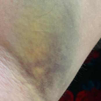 Atrius Health - The talented phlebotomists at Atrius Health, everyone! - Medical Centers Near Me - Somerville, Massachusetts