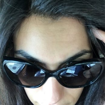 Glow Medical Aesthetics - Right after Botox injection. No redness, No bleeding. - Skin Care Near Me - Houston, Texas Glow Medical Aesthetics - Right after Botox injection. No redness, No bleeding. - Skin Care Near Me - Houston, Texas