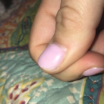 Grand Nails Bar - Thumb chipped - Nail Salons Near Me - Richmond, Texas Grand Nails Bar - Thumb chipped - Nail Salons Near Me - Richmond, Texas