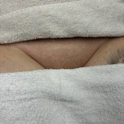 Alaura Beauty - Brazilian wax