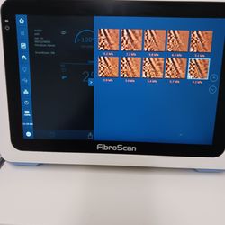 Charter Research - Liver density scan