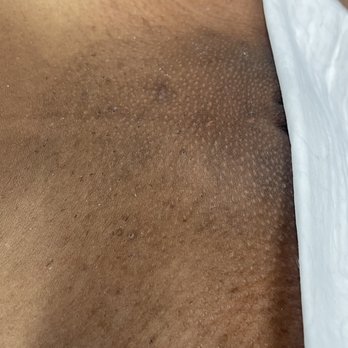 Goddess sugaring wax center - Waxing Near Me - Norcross, Georgia
