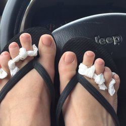 Shirley Nail - Also note that my pinky toes don't match in length