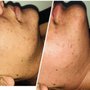 Photo of Queens Laser Hair Removal