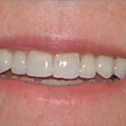 Aeris Family Dental - After pic
