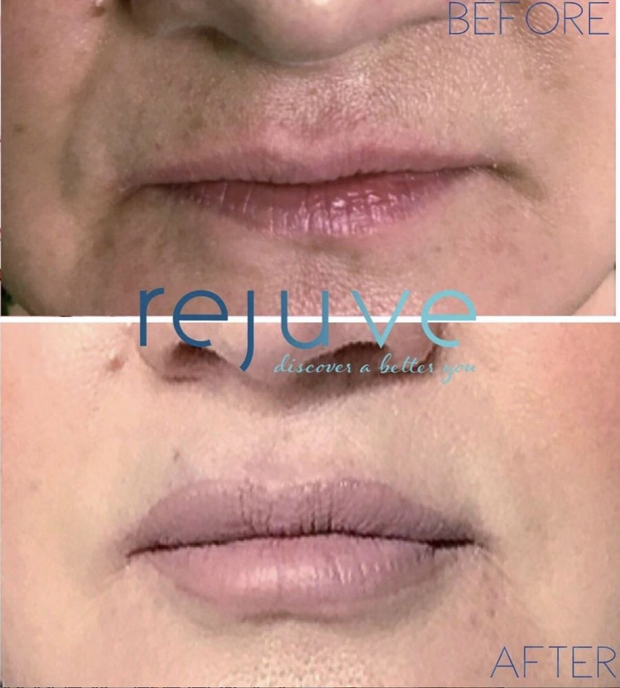 REJUVE HOUSTON Updated September 2024 Request an Appointment