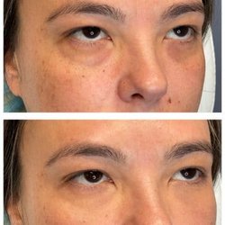 Cameo Facial Aesthetics