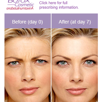 Northshore Skincare - Before and After Botox - Medical Spas Near Me - Covington, Louisiana Northshore Skincare - Before and After Botox - Medical Spas Near Me - Covington, Louisiana